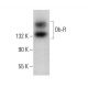 western blotting image from recommended Ob-R/Leptin Receptor (B-3) monoclonal antibody replacement. Image 376082