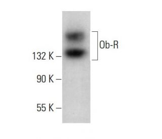 western blotting image from recommended Ob-R/Leptin Receptor (B-3) monoclonal antibody replacement. Image 376082