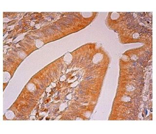 ODC Antibody (G-10) - Immunohistochemistry - Image 301852 