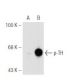 Okadaic Acid: sc-3513. Western blot analysis of TH phosphorylation in untreated (A) and Okadaic Acid-treated: sc-3513 (B) 