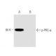 Okadaic Acid: sc-3513. Western blot analysis of PKC α phosphorylation in Calyculin A: sc-24000 and Okadaic Acid-trea