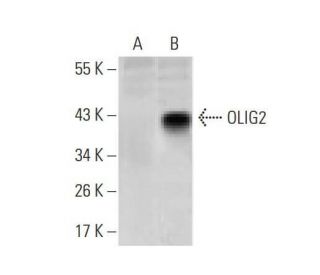 OLIG2 Antibody (1G11) - Western Blotting - Image 358261