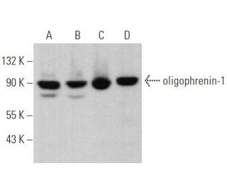 western blotting image from recommended oligophrenin-1 (A-12) monoclonal antibody replacement. Image 374940