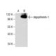 oligophrenin-1 Antibody (D-2) - Western Blotting - Image 157657