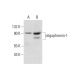 oligophrenin-1 Antibody (D-2) - Western Blotting - Image 325209 