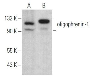 oligophrenin-1 Antibody (E-4) - Western Blotting - Image 375003 