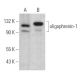 oligophrenin-1 Antibody (E-4) - Western Blotting - Image 375003 