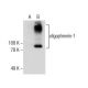oligophrenin-1 Antibody (E-8) - Western Blotting - Image 155633 