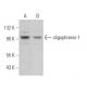oligophrenin-1 Antibody (E-8) - Western Blotting - Image 375004