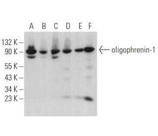 oligophrenin-1 Antibody (G-6) - Western Blotting - Image 374944 