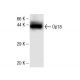Op18 Antibody (13) - Western Blotting - Image 136768