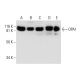 This polyclonal antibody has been discontinued. See our recommended <a href="opa1-antibody-d-9">OPA1 (D-9)</a> monoclonal antibody (sample data shown). western blotting image from recommended OPA1 (D-9) monoclonal antibody replacement. Image 294530