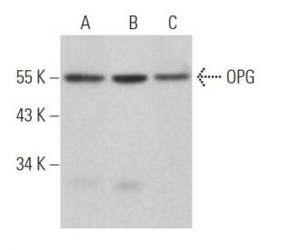 western blotting image from recommended OPG/Osteoprotegerin (E-10) monoclonal antibody replacement. Image 361683