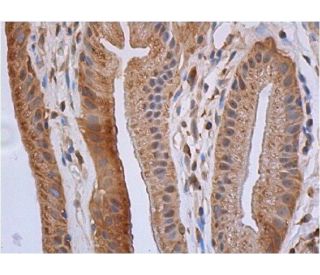 osteopontin/OPN/SPP1 Antibody (AKm2A1) - Immunohistochemistry - Image 353913 