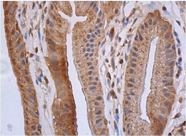 osteopontin/OPN/SPP1抗体(AKm2A1) | SCBT - Santa Cruz Biotechnology