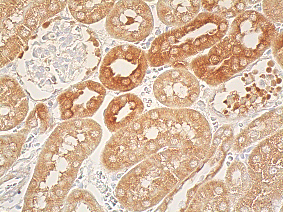 osteopontin/OPN/SPP1抗体(AKm2A1) | SCBT - Santa Cruz Biotechnology