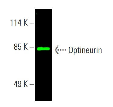 TIP60 Antibody (C-7) | SCBT - Santa Cruz Biotechnology