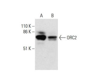 western blotting image from recommended ORC2 (3G6) monoclonal antibody replacement. Image 289524