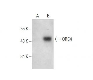 western blotting image from recommended ORC4 (H-2) monoclonal antibody replacement. Image 304507