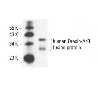western blotting image from recommended Orexin-A (KK09) monoclonal antibody replacement. Image 404626