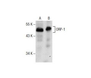 ORP-1 Antibody (B-3) - Western Blotting - Image 157512
