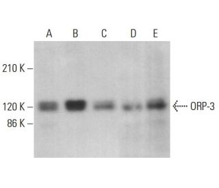 ORP-3 Antibody (D-12) - Western Blotting - Image 379707 