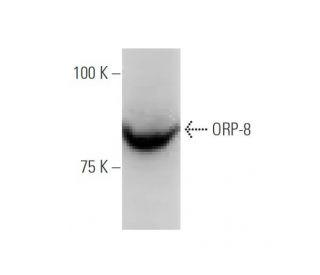 ORP-8 Antibody (PL-C26) - Western Blotting - Image 65023