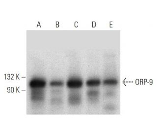 ORP-9 Antibody (A-7) - Western Blotting - Image 312012 