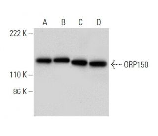 ORP150 Antibody (A-3) - Western Blotting - Image 303385 