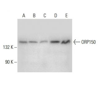 ORP150 Antibody (C-9) - Western Blotting - Image 301363