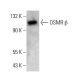 OSMR β Antibody (AN-U2) - Western Blotting - Image 379217