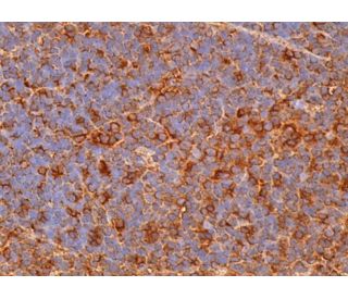 OSMR &beta; Antibody (C-12) - Immunohistochemistry - Image 379106 