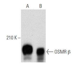 OSMR &beta; Antibody (C-7) - Western Blotting - Image 357001 