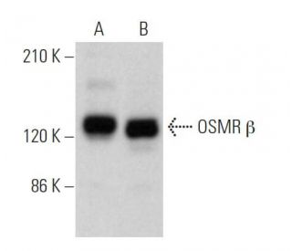 OSMR β Antibody (D-10) - Western Blotting - Image 371555