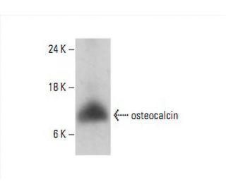 osteocalcin Antibody (C-7) - Western Blotting - Image 394068 