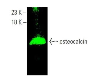 western blotting image from recommended osteocalcin (G-5) monoclonal antibody replacement. Image 374225