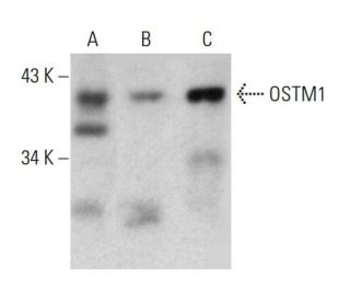 OSTM1 Antibody (4H1) - Western Blotting - Image 384272 