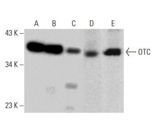 OTC Antibody (E-9) - Western Blotting - Image 386879 