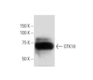 OTK18 Antibody (211-3.1-1) - Western Blotting - Image 137424 