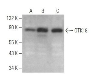 OTK18 Antibody (E-9) - Western Blotting - Image 372825 
