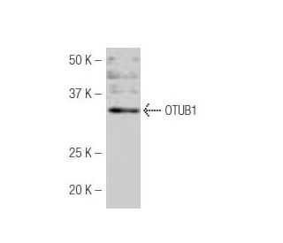 OTUB1 Antibody (J-61) - Western Blotting - Image 53958Each CRISPR/Cas9 Knockout (KO) Plasmid product consists of a pool of 3 plasmids designed to ensure identification and cleavage of a specific gene for maximum knockout efficiency. Each plasmid encodes a unique 20 nt sequence derived from the GeCKO (v2) library.