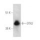 OTX2 Antibody (D-8) - Western Blotting - Image 389371