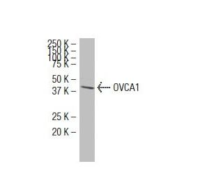 OVCA1 Antibody (6E93) - Western Blotting - Image 34607 