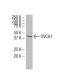 OVCA1 Antibody (6E93) - Western Blotting - Image 34607 