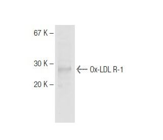 western blotting image from recommended Ox-LDL R-1 (LOX19-22) monoclonal antibody replacement. Image 64668