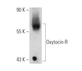 western blotting image from recommended Oxytocin-R (C-4) monoclonal antibody replacement. Image 364982