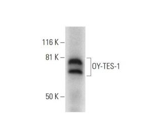 OY-TES-1 Antibody (G-5) - Western Blotting - Image 289598 