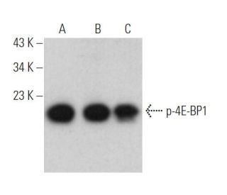 western blotting image from recommended p-4E-BP1 (62.Ser 65) monoclonal antibody replacement. Image 374876