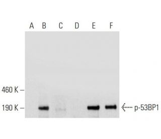 p-53BP1 Antibody (38.Ser 25) - Western Blotting - Image 144630 