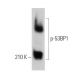 p-53BP1 Antibody (38.Ser 25) - Western Blotting - Image 373038